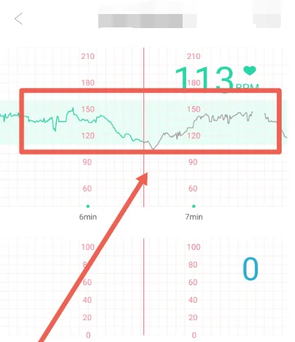 微胎心app胎心监护查看方法