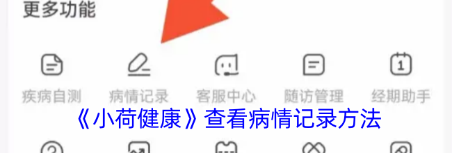 《小荷健康》查看病情记录方法